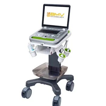 Hopsital Clinic 3D 4D цветен доплеровский ултразвуков скенер, устройство за лаптоп, лесен led монитор за диагностика